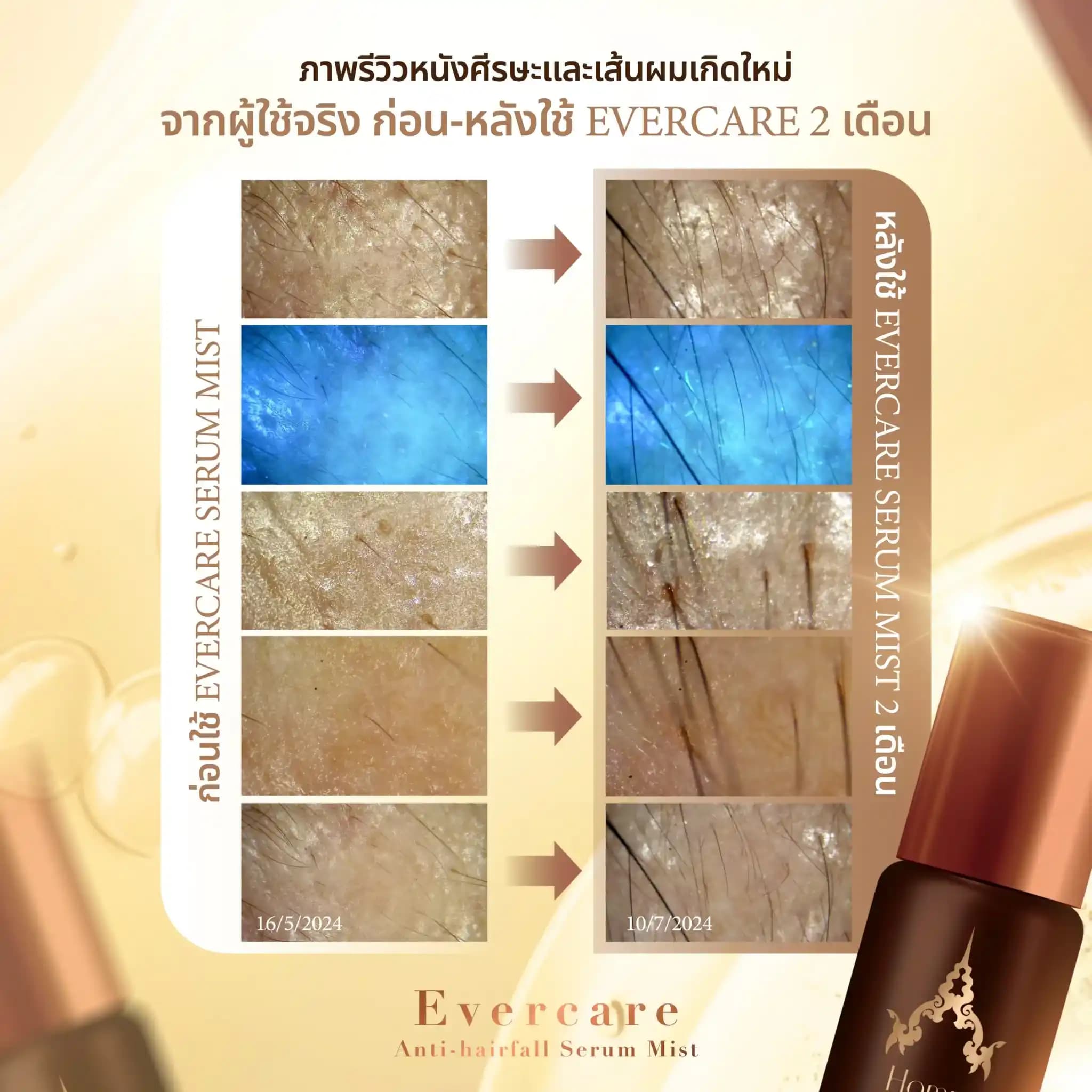 Evercare Product 12