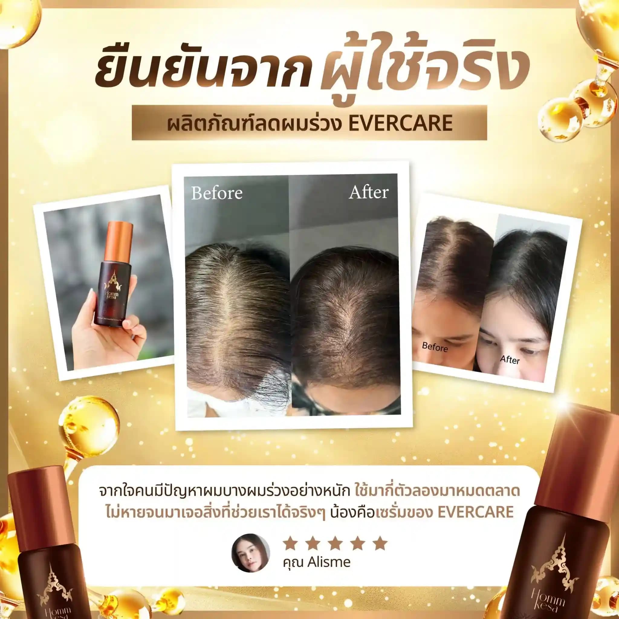 Evercare Product 18