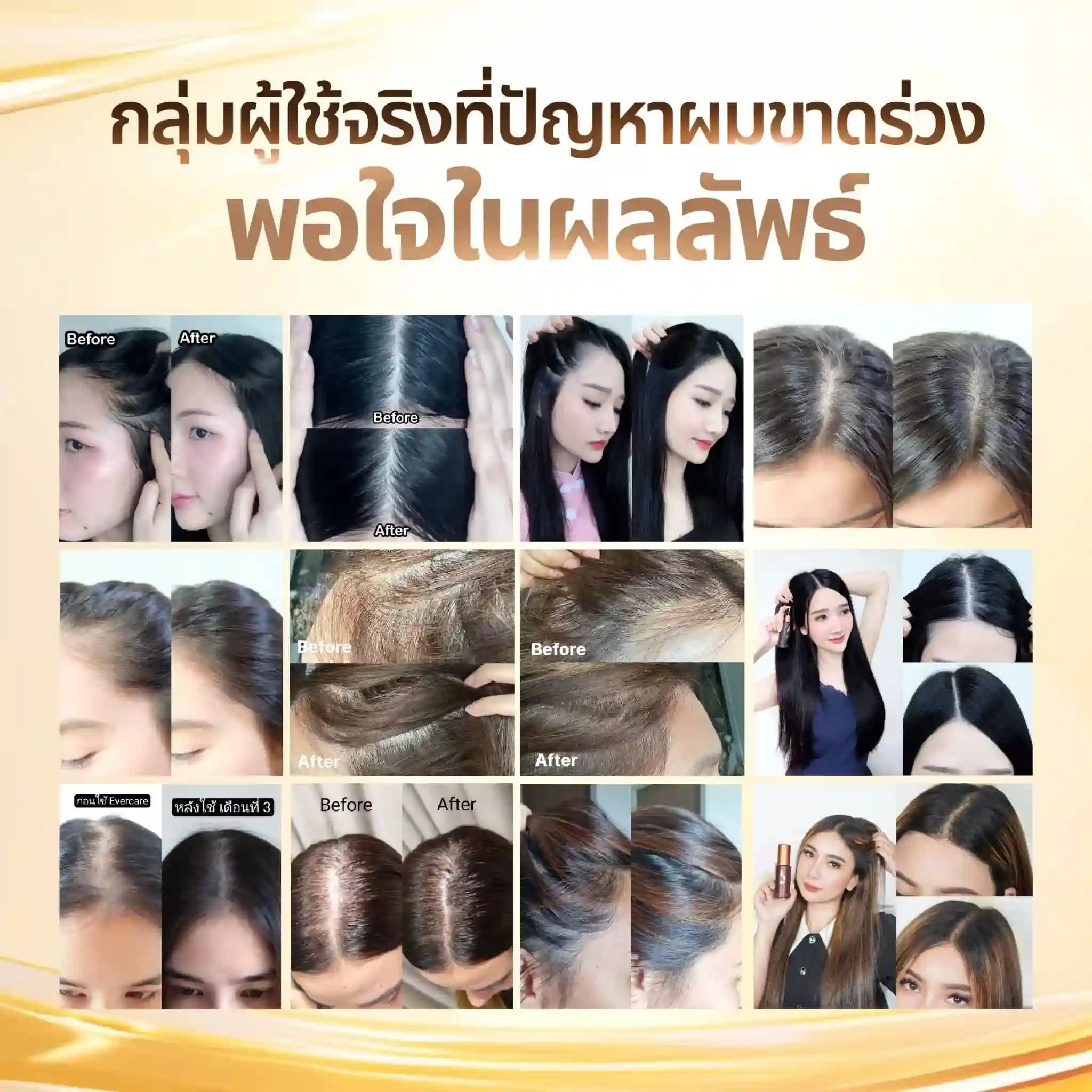 Evercare Product 19