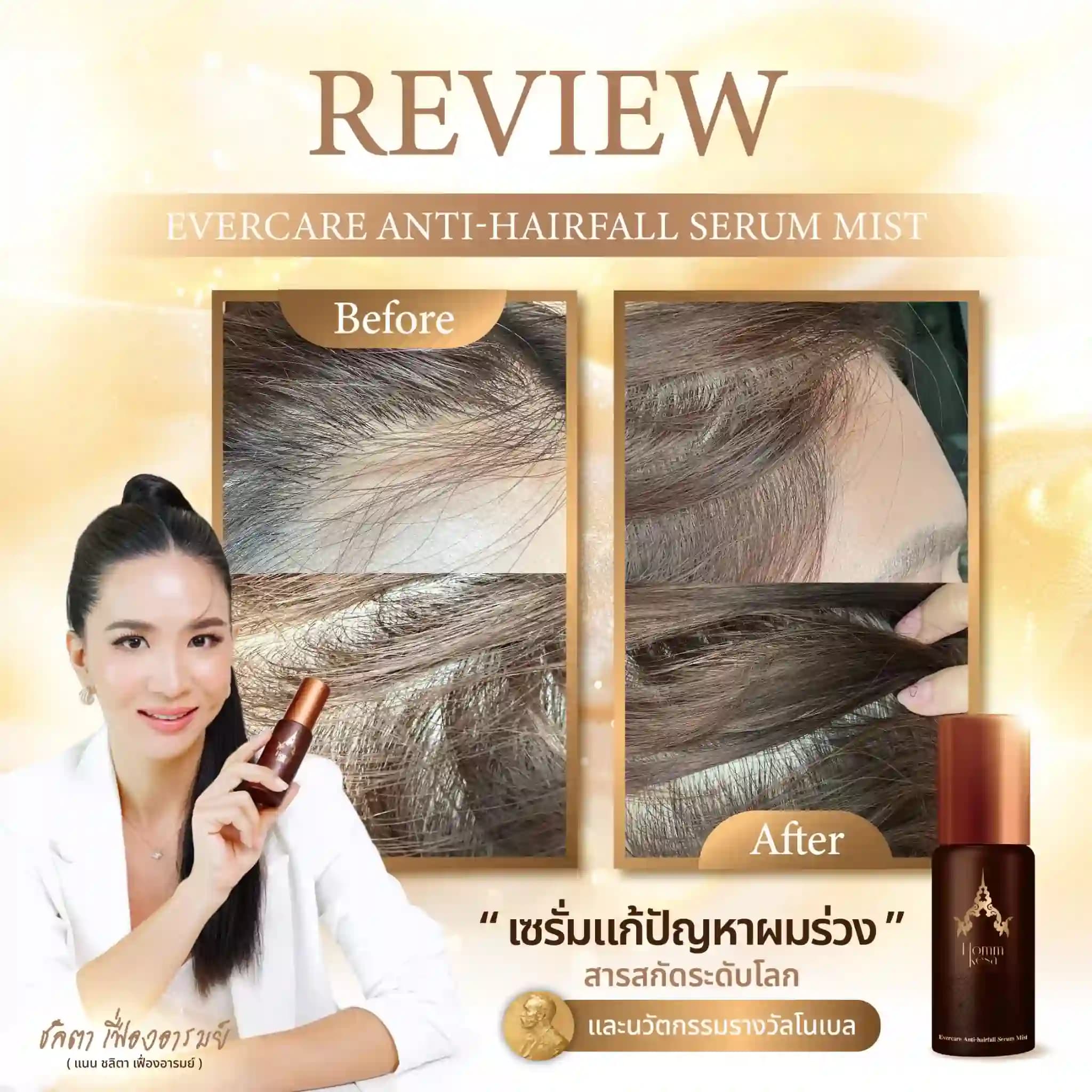 Evercare Product 20