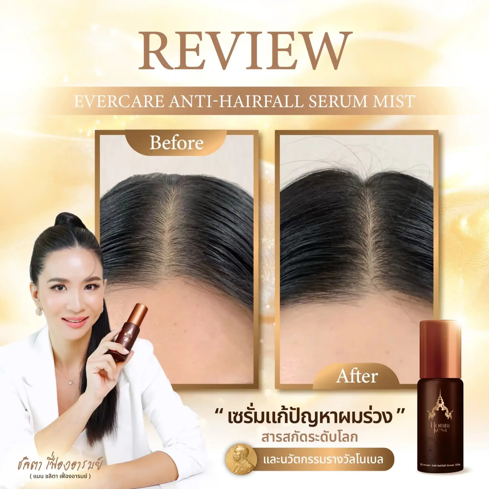 Evercare Product 22