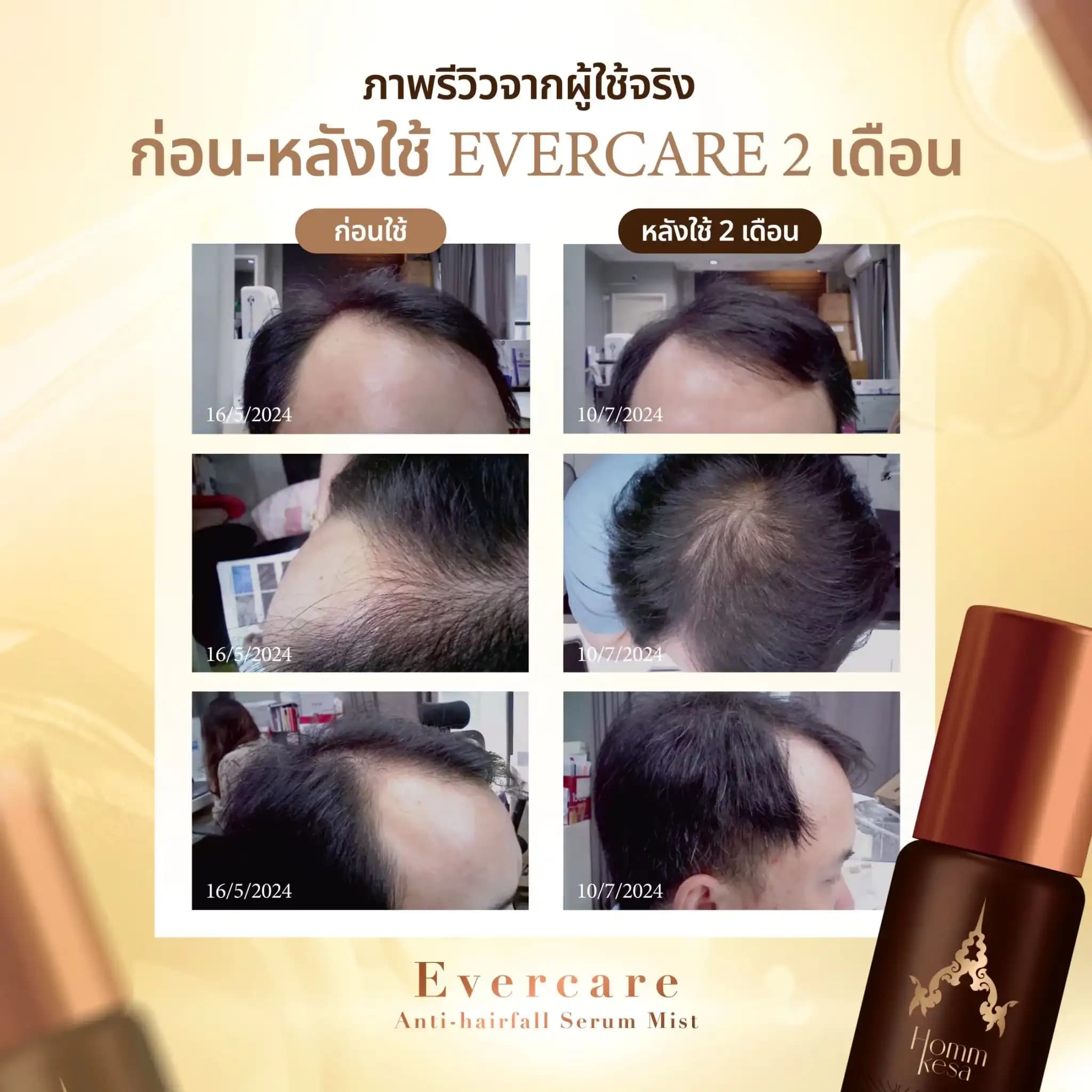 Evercare Product 23